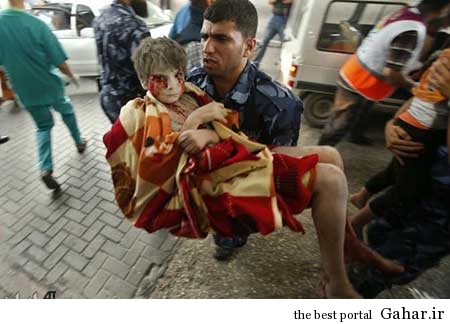 9304 6m390 کودکان غزه غرق در خون / عکس (18+)