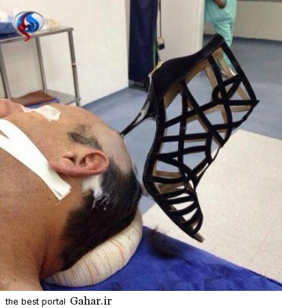 حادثه دلخراش با پاشنه تیز کفش زنانه