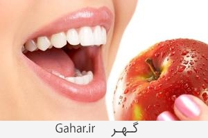 سفید کردن دندان ها با 6 راه طبیعی و خانگی