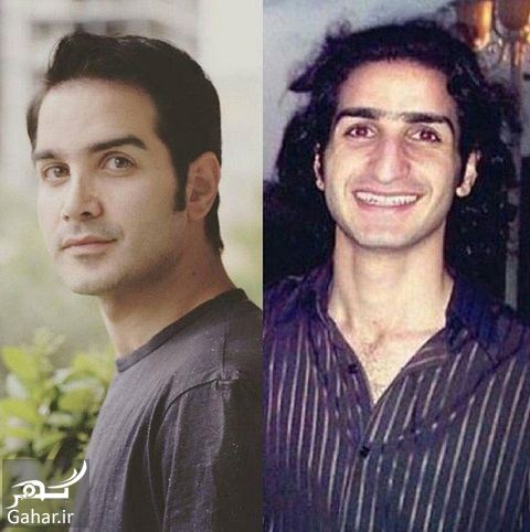 چهره باورنکردنی خواننده معروف قبل عمل! / عکس
