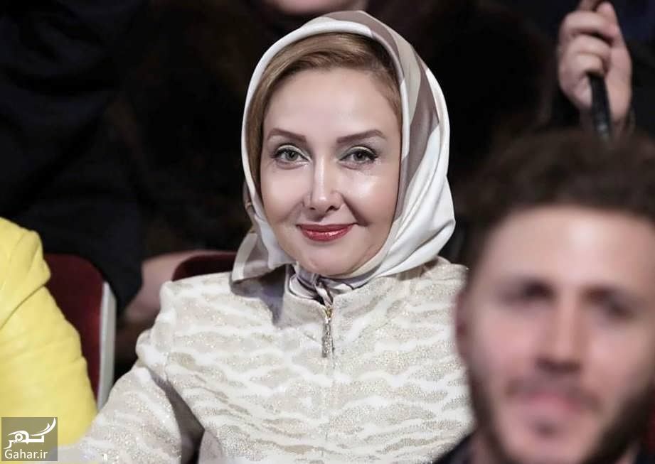 بازیگرانی که عمل زیبایی برایشان گران تمام شد / عکس