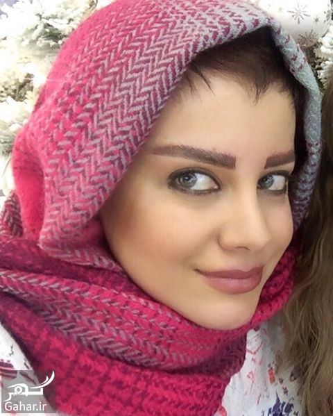 بازیگرانی که عمل زیبایی برایشان گران تمام شد / عکس