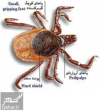 علایم تب کریمه کنگو