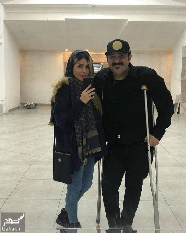 عکس آینه ای مهران غفوریان و همسرش بعد از عمل, جدید 1400 -گهر