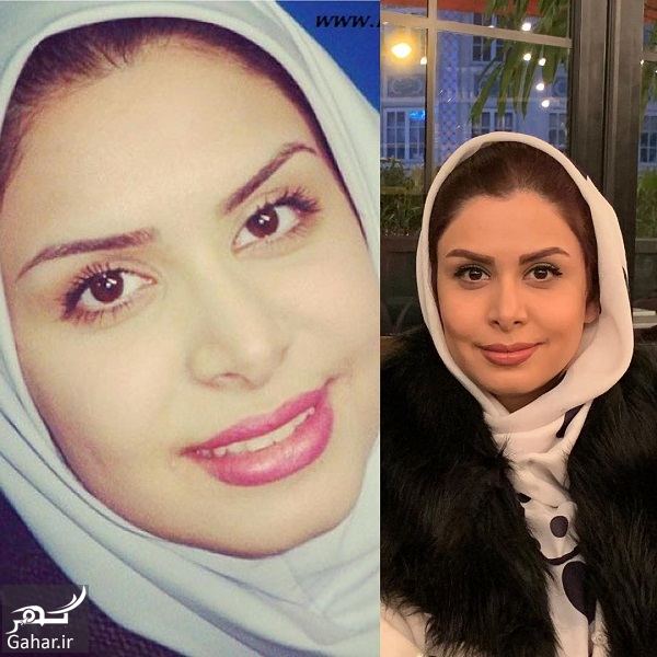 عکسهای بازیگران در چالش 10 سال پیش