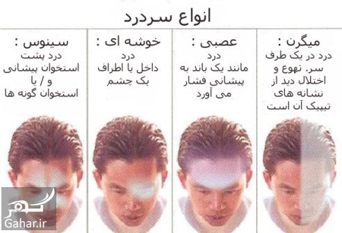 درمان سردرد عصبی