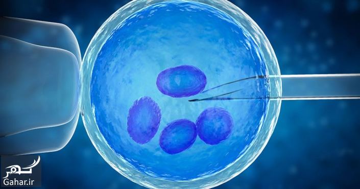 هزینه آی وی اف در سال ۱۴۰۱ ivf