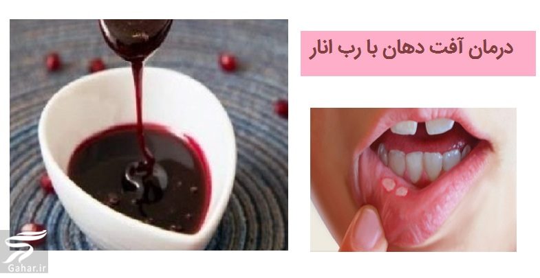 درمان آفت دهان با رب انار