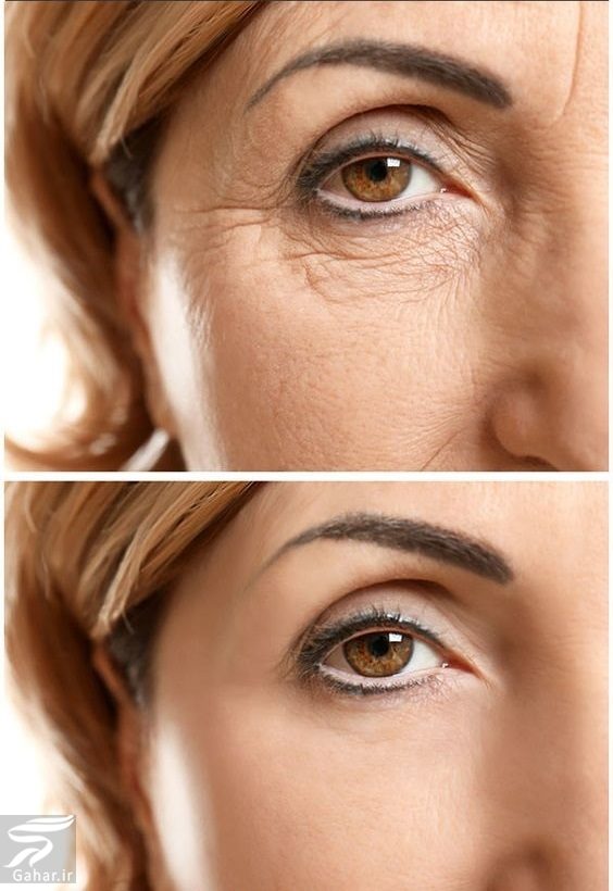 تهیه کرم دور چشم خانگی