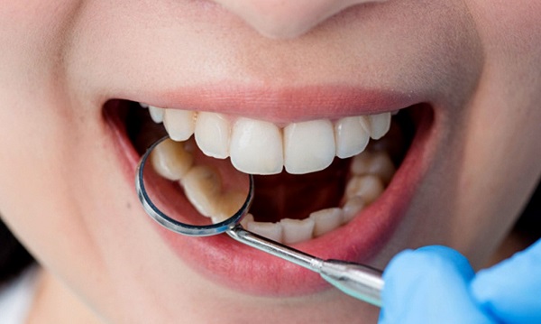 بهترین خدمات دندانپزشکی برای اصلاح طرح لبخند چیست ؟