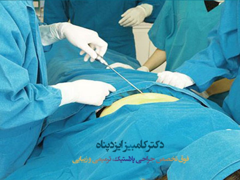 لیپوماتیک: تخلیه چربی های شکم تنها در  2 ساعت