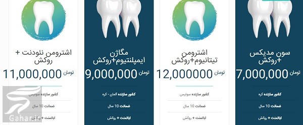 قیمت ایمپلنت دندان دکتر آقاجری