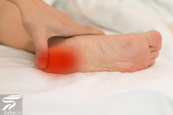 داغ شدن و سوزش کف پا نشانه چیست