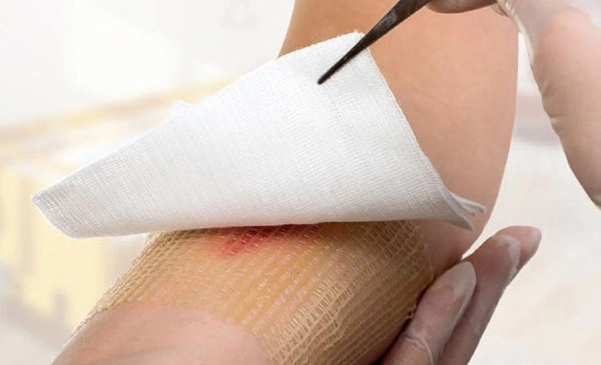برای کاهش التهابات پوستی پرتو درمانی چیکار کنیم؟