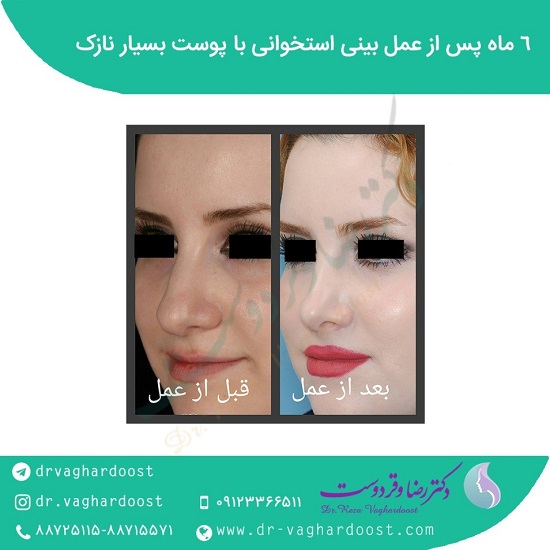 بهترین جراح بینی در تهران