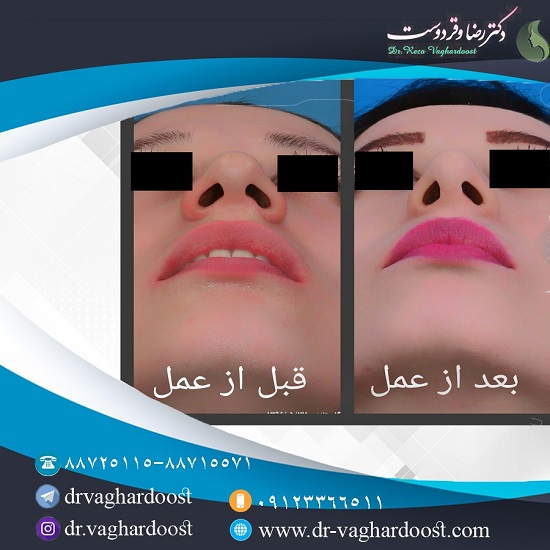 بهترین جراح بینی در تهران