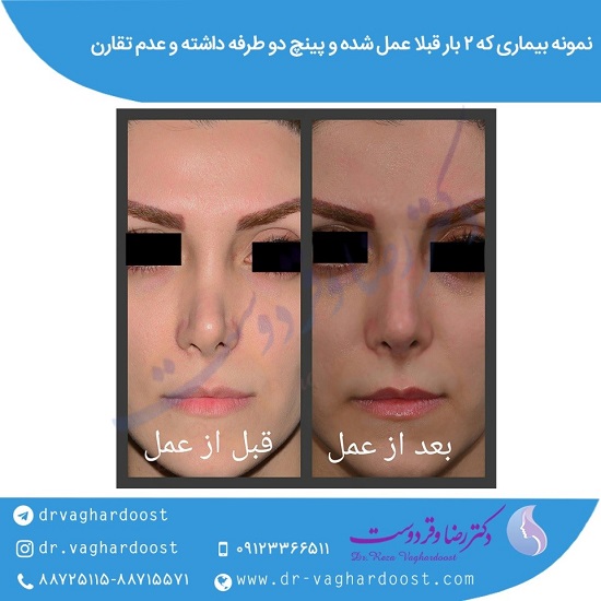 بهترین جراح بینی در تهران