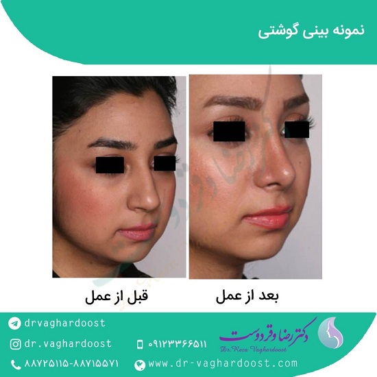 بهترین جراح بینی در تهران
